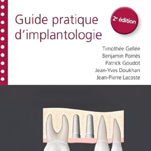 Guide pratique d'implantologie 2e édition
