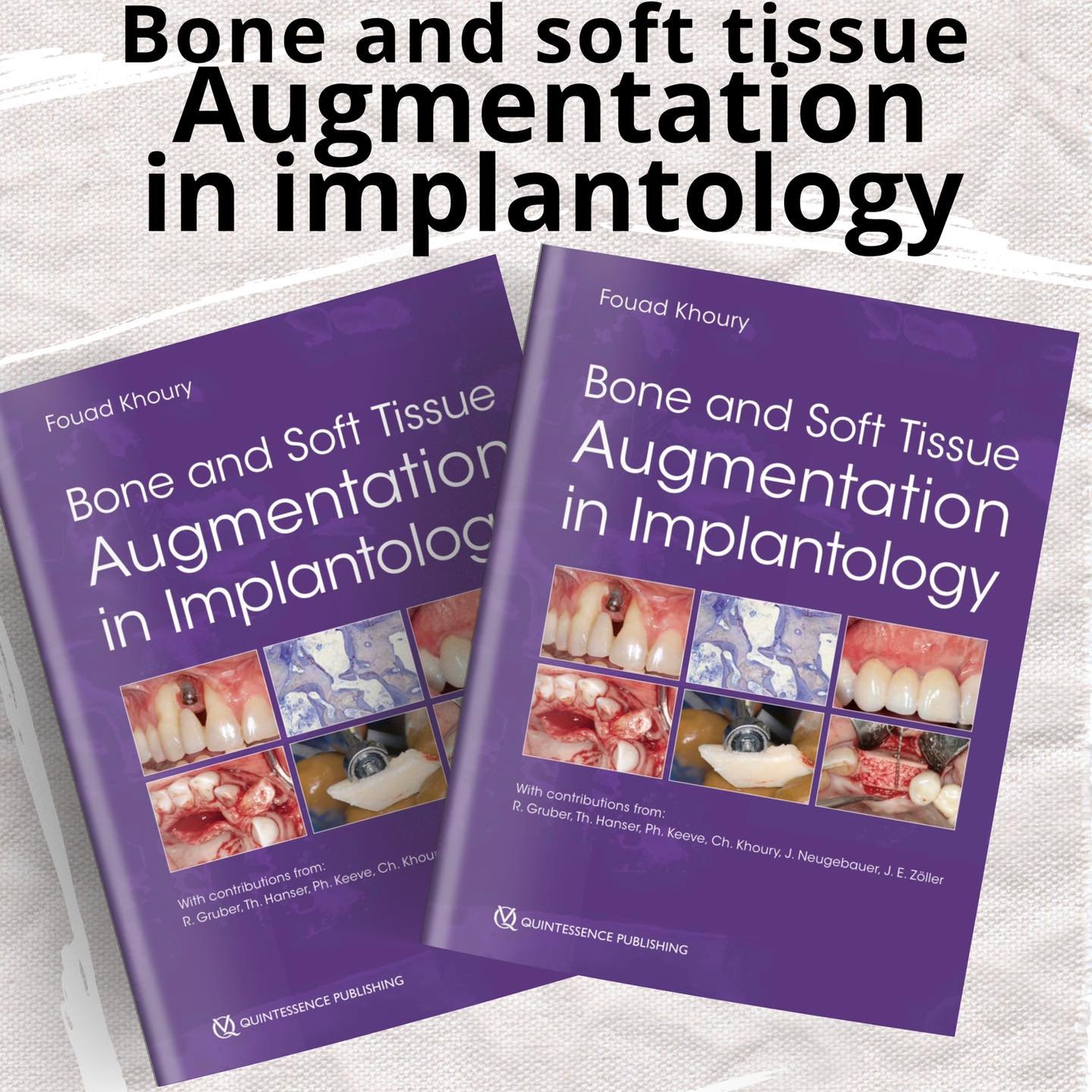 Bone and Soft Tissue Augmentation in Implantology - Derradji Dental Store